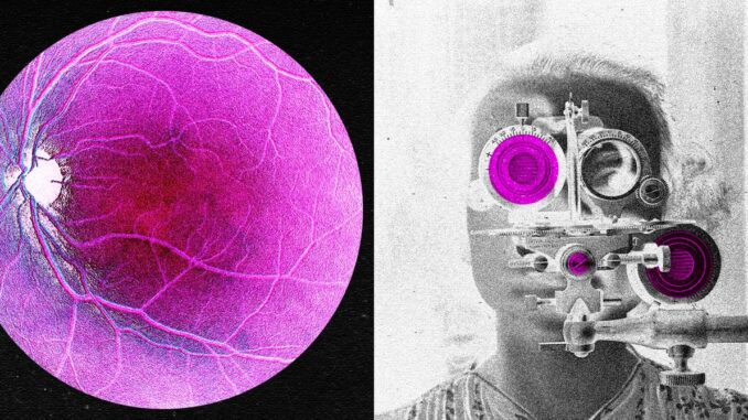 Longevity Startup Doses First Human in Bid to Reverse Age-Related Sight Loss