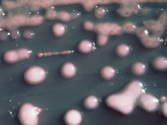 A woman got a UTI. Two years later, the bacteria had evolved, invaded her brain.