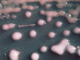 A woman got a UTI. Two years later, the bacteria had evolved, invaded her brain.